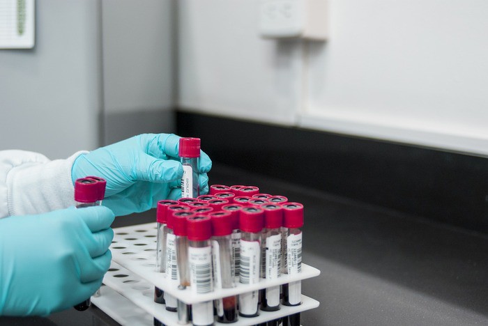 Microplastica: trovati frammenti per la prima volta nel sangue umano