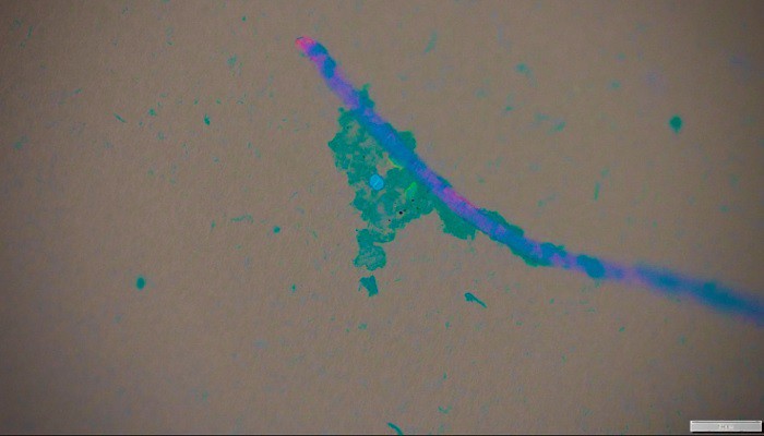 Microplastica: i parassiti possono usare le particelle come taxi verso il mare