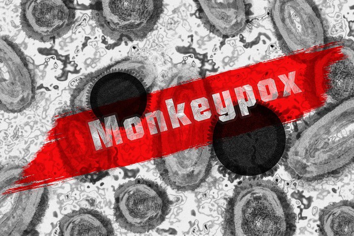 Vaiolo delle scimmie: il Tpoxx cura l’infezione, ma è difficile da ottenere